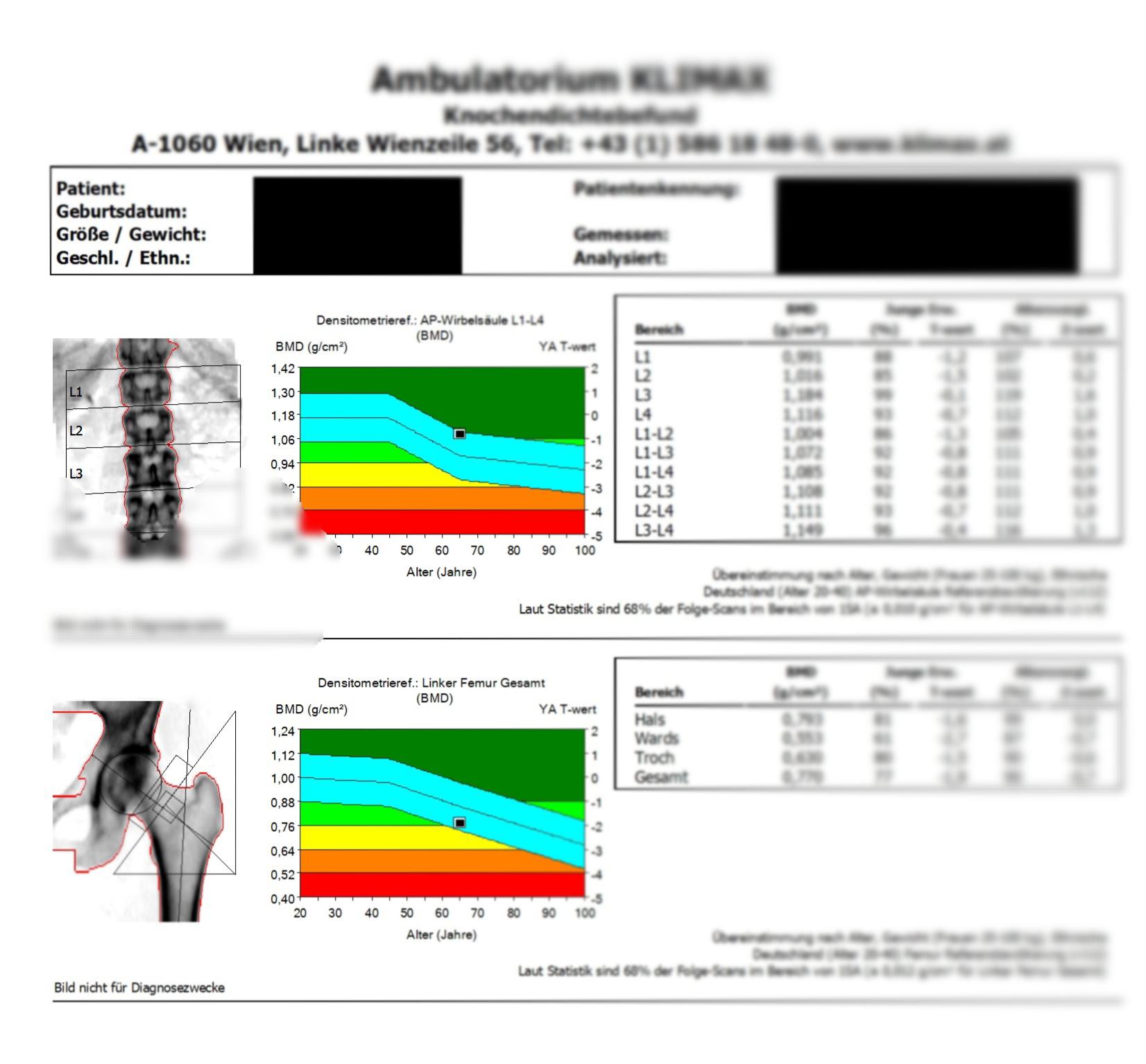 Untersuchungen bei Osteoporose